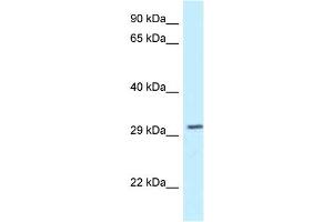 WB Suggested Anti-Tollip Antibody   Titration: 1. (TOLLIP 抗体  (N-Term))