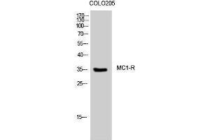 Western Blotting (WB) image for anti-Melanocortin 1 Receptor (MC1R) (C-Term) antibody (ABIN3185484) (MC1 Receptor 抗体  (C-Term))