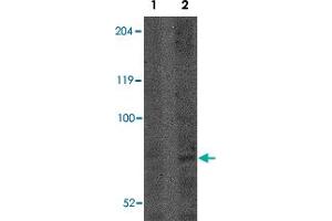 Western blot analysis of CNOT4 in A-549 lysate with CNOT4 polyclonal antibody  at (Lane 1) 1 and (Lane 2) 2 ug/mL . (CNOT4 抗体  (N-Term))