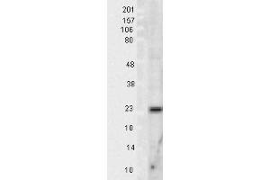 Western blot analysis of Rat Tissue lysates showing detection of SOD2 protein using Rabbit Anti-SOD2 Polyclonal Antibody . (SOD2 抗体  (Biotin))