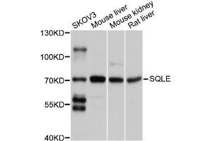 Western blot analysis of extracts of various cell lines, using SQLE antibody (ABIN5998952) at 1/1000 dilution. (SQLE 抗体)