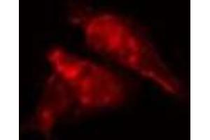 ABIN6277218 staining  HepG2 cells by IF/ICC. (EPB41 抗体  (Internal Region))