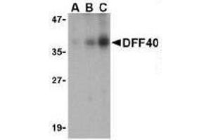 Immunocytochemical staining of DFF40 in K562 cells with DFF40 antibody at 10μg/ml. (DFFB 抗体  (AA 203-218))