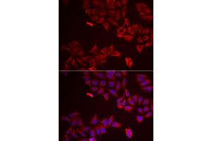 Immunofluorescence analysis of A549 cells using LGALS8 antibody. (LGALS8 抗体)