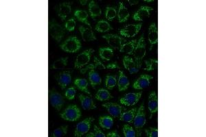 Immunofluorescence analysis of L929 cells using MTIF2 Polyclonal Antibody (ABIN7268591) at dilution of 1:100 (40x lens).