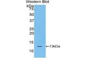 Detection of Recombinant S100A10, Bovine using Polyclonal Antibody to S100 Calcium Binding Protein A10 (S100A10) (S100A10 抗体)