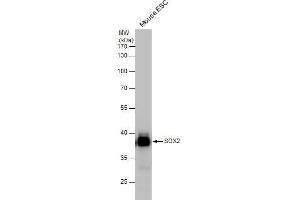 Western Blotting (WB) image for anti-SRY (Sex Determining Region Y)-Box 2 (SOX2) antibody (ABIN2855074)