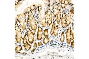 Immunohistochemistry (IHC) image for anti-NADPH Oxidase 4 (NOX4) (AA 328-578) antibody (ABIN6144752)