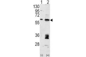 Western blot analysis of anti-MDM2 antibody and 293 cell lysate (2 ug/lane) either nontransfected (Lane 1) or transiently transfected with the MDM2 gene (2). (MDM2 抗体  (AA 393-424))