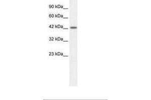 Image no. 2 for anti-Activating Transcription Factor 2 (ATF2) (AA 401-450) antibody (ABIN202679) (ATF2 抗体  (AA 401-450))