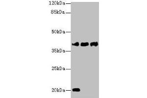 Western blot All lanes: STEAP1 antibody at 1 μg/mL Lane 1: U87 whole cell lysate Lane 2: A431 whole cell lysate Lane 3: A549 whole cell lysate Secondary Goat polyclonal to rabbit IgG at 1/10000 dilution Predicted band size: 40 kDa Observed band size: 40 kDa (STEAP1 抗体  (AA 3-69))