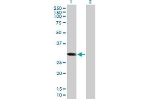Western Blotting (WB) image for anti-ATP-Binding Cassette, Sub-Family C (CFTR/MRP), Member 10 (ABCC10) (AA 1-282) antibody (ABIN529931)