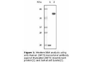 Image no. 2 for anti-zeta-Chain (TCR) Associated Protein Kinase 70kDa (ZAP70) antibody (ABIN207619) (ZAP70 抗体)