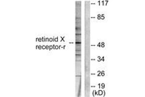 Western Blotting (WB) image for anti-Retinoid X Receptor, gamma (RXRG) (AA 171-220) antibody (ABIN2889254) (Retinoid X Receptor gamma 抗体  (AA 171-220))