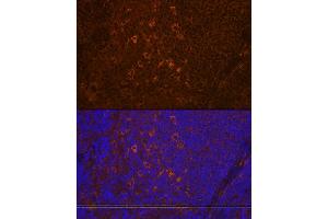 Immunofluorescence analysis of rat spleen using PLC gamma 2 (PLC gamma 2 (PLCG2)) Rabbit mAb (ABIN7269342) at dilution of 1:100 (40x lens). (Phospholipase C gamma 2 抗体)