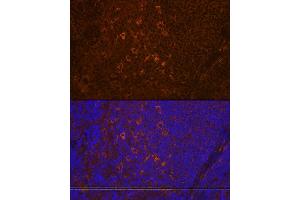 Immunofluorescence analysis of rat spleen using PLC gamma 2 (PLC gamma 2 (PLCG2)) Rabbit mAb (ABIN7269342) at dilution of 1:100 (40x lens).