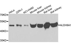 Western blot analysis of extracts of various cell lines, using ALDH9A1 antibody (ABIN5995392) at 1/500 dilution. (ALDH9A1 抗体)