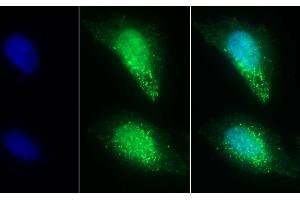 Detection of ST2 in Human U2OS cell using Polyclonal Antibody to Syntenin 2 (ST2) (SDCBP2 抗体  (AA 1-292))