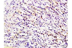 Immunohistochemistry (Paraffin-embedded Sections) (IHC (p)) image for anti-DEAD (Asp-Glu-Ala-Asp) Box Polypeptide 58 (DDX58) (AA 201-300) antibody (ABIN730663) (DDX58 抗体  (AA 201-300))