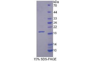 SDS-PAGE analysis of Human XYLT1 Protein. (XYLT1 蛋白)