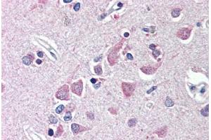 Human Brain, Cortex (formalin-fixed, paraffin-embedded) stained with FEM1B antibody ABIN214493 at 10 ug/ml followed by biotinylated goat anti-rabbit IgG secondary antibody ABIN481713, alkaline phosphatase-streptavidin and chromogen. (FEM1B 抗体  (AA 609-622))