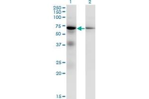 Western Blotting (WB) image for anti-Eukaryotic Translation Initiation Factor 2-alpha Kinase 2 (EIF2AK2) (AA 1-101) antibody (ABIN598900) (EIF2AK2 抗体  (AA 1-101))