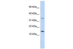 Leptin antibody used at 1 ug/ml to detect target protein. (Leptin 抗体  (Middle Region))