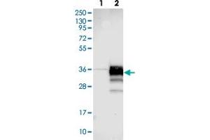 Western blot analysis of Lane 1: Negative control (vector only transfected HEK293T lysate). (STARD3NL 抗体)