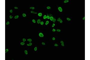 Immunofluorescence staining of Hela cells with ABIN7139625 at 1:2. (HIST1H1E 抗体  (pThr17))