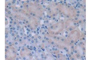 Detection of MYLK2 in Mouse Kidney Tissue using Polyclonal Antibody to Myosin Light Chain Kinase 2 (MYLK2)