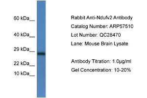 Western Blotting (WB) image for anti-NADH Dehydrogenase (Ubiquinone) Flavoprotein 2, 24kDa (NDUFV2) (C-Term) antibody (ABIN2787254) (NDUFV2 抗体  (C-Term))