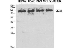 Western Blot (WB) analysis of specific cells using CD31 Polyclonal Antibody. (CD31 抗体  (Thr224))