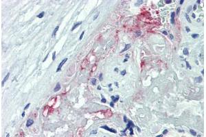 Human Placenta: Formalin-Fixed, Paraffin-Embedded (FFPE) (ADAM8 抗体  (AA 763-824))