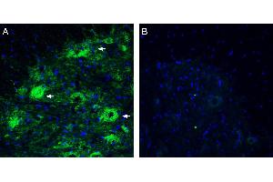 Expression of Netrin-3 in rat spinal cord.