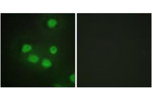 Immunofluorescence analysis of HepG2 cells, using SIX6 Antibody. (SIX Homeobox 6 抗体  (AA 121-170))