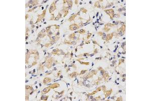 Immunohistochemistry of paraffin-embedded human stomach using CDC20 antibody at dilution of 1:200 (x400 lens) (CDC20 抗体)