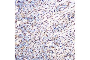 Immunohistochemistry of paraffin-embedded human esophageal using GLUD1 Rabbit mAb (ABIN7267411) at dilution of 1:100 (40x lens). (GLUD1 抗体)