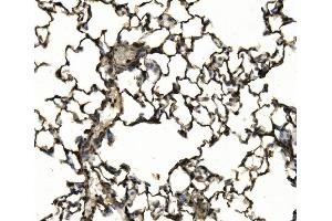 IHC analysis of CD11c/Itgax using anti-CD11c/Itgax antibody (ABIN7600041).