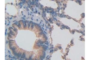 Detection of INHbB in Rat Lung Tissue using Polyclonal Antibody to Inhibin Beta B (INHbB) (INHBB 抗体  (AA 297-411))