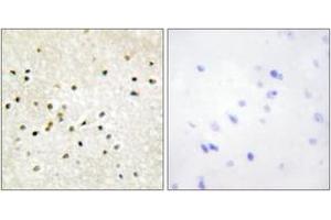 Immunohistochemistry (IHC) image for anti-General Transcription Factor IIH, Polypeptide 1, 62kDa (GTF2H1) (AA 15-64) antibody (ABIN1533699)