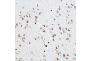 Immunohistochemistry of paraffin-embedded Rat brain using PLZF antibody (ABIN6128472, ABIN6150368, ABIN6150369 and ABIN6221570) at dilution of 1:200 (40x lens). (ZBTB16 抗体  (AA 1-220))