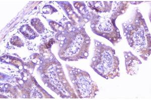 IHC analysis of cortactin using anti-cortactin antibody (ABIN6719306). (Cortactin 抗体  (AA 1-105))
