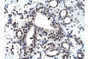ZNF499 antibody was used for immunohistochemistry at a concentration of 4-8 ug/ml to stain Epithelial cells of collecting tubule (arrows) in Human Kidney. (ZBTB45 抗体  (Middle Region))