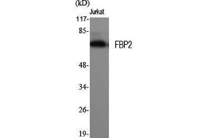 Western Blot (WB) analysis of specific cells using FBP2 Polyclonal Antibody. (FBP2 抗体  (N-Term))
