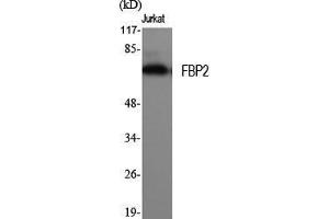 Western Blot (WB) analysis of specific cells using FBP2 Polyclonal Antibody. (FBP2 抗体  (N-Term))