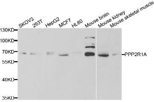 Western blot analysis of extracts of various cell lines, using PPP2R1A antibody. (PPP2R1A 抗体)