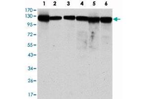 Western blot analysis using MCM2 monoclonal antibody, clone 1E7  against MCF-7 (1), HeLa (2), Jurkat (3), K-562 (4), HEK293 (5) and HEPG2 (6) cell lysate. (MCM2 抗体)