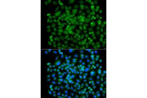 Immunofluorescence analysis of A549 cell using PSMB8 antibody. (PSMB8 抗体)