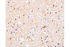 Immunohistochemistry of NGFRAP1 in human brain tissue with NGFRAP1 polyclonal antibody  at 2 ug/mL . (Nerve Growth Factor Receptor (TNFRSF16) Associated Protein 1 (NGFRAP1) (Internal Region) 抗体)