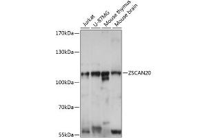Western blot analysis of extracts of various cell lines, using ZSC antibody (ABIN7271443) at 1:1000 dilution. (ZSCAN20 抗体  (AA 1-200))